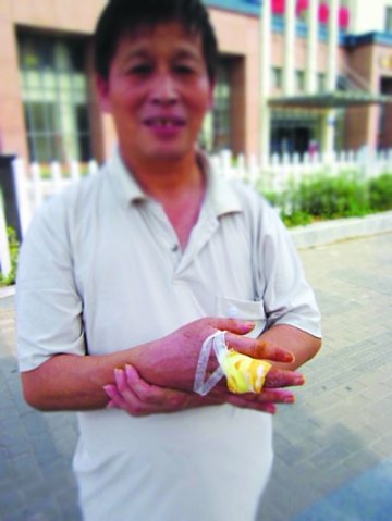 环卫工遇“化尸水”病毒 手指划道小口险送命