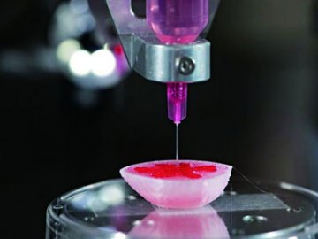 3D打印引领医学革命