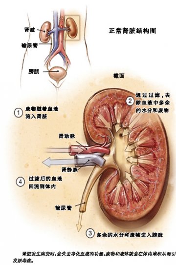 慢性肾炎易误诊，诊断须谨慎