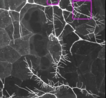 Curr Biol：揭示感觉神经元对于触觉重要性的分子机制