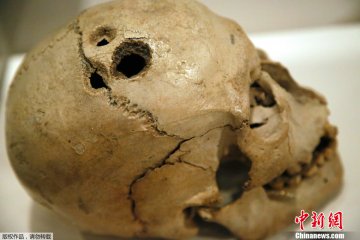 有300年历史的头盖骨
