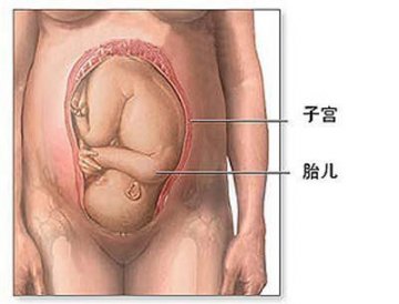 女性剖腹产手术全过程图解