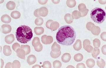 白细胞形态（leukocyte；leucocyte；white blood cell）