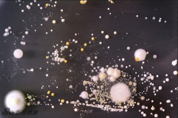 清晰地看到手机上的大量细菌
