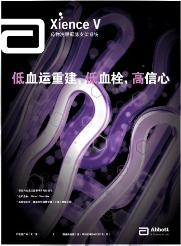 药物洗脱冠脉支架系统-XIENCE (TM) V官方高清创意广告(沪医械广审(文)第2013020081号)