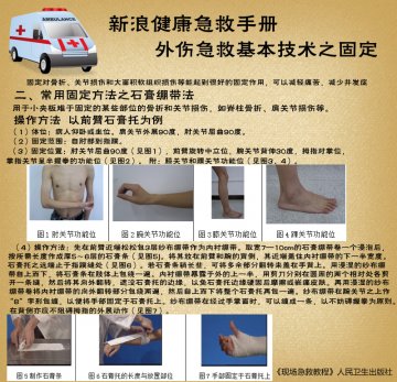石膏绷带固定法操作方法