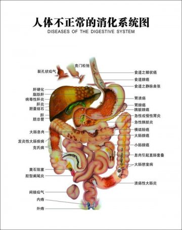 军医提示：胃肠手术后吃喝有讲究