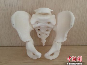 “骨骼打印机”亮相重庆 可立体打印患者骨骼