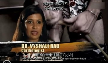 医学解读：男子腿绑香肠冒充阳物为何丧命