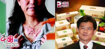消费者状告完美保健品致身体溃烂 完美公司拒绝回应