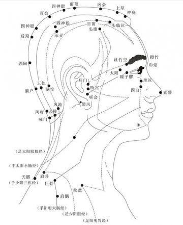 头