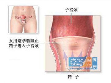 女性避孕：目击女人避孕全过程