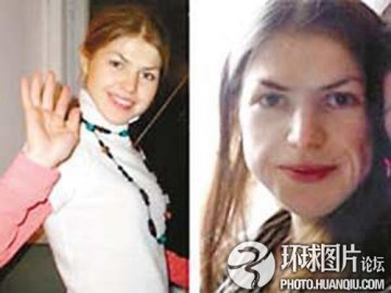 盘点：惨不忍睹的减肥后遗症