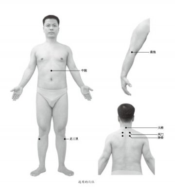 中医保健：感冒后灸五个穴位