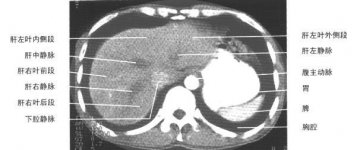 正常腹部CT（1）