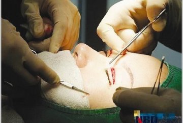 医疗美容“乱象”调查：越界经营 普遍无证