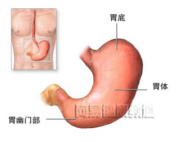 胃切除术