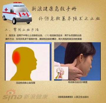 指压止血方法：枕动脉压迫法