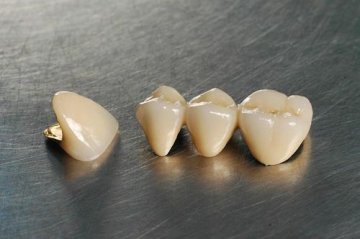 假牙导致肾病？健康隐患引发巨大争议