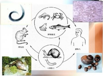 广州管圆线虫病预防相关知识