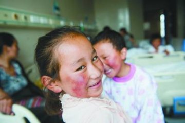 西藏先心病患儿抵京接受免费治疗