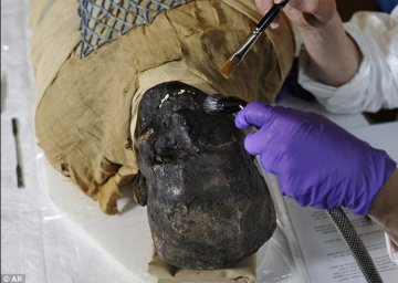 美医院开棺清理修复埃及2500年木乃伊