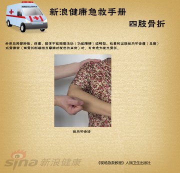 四肢骨折