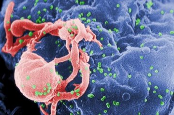 《自然》：科学家揭开人体抵抗艾滋病病毒之谜