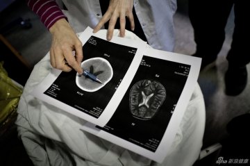 23.医生向Vibe的父母出示她的检查结果
