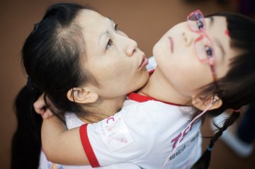结节性硬化症患者妞妞的故事