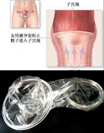 性福春节：女性新式避孕方法大全