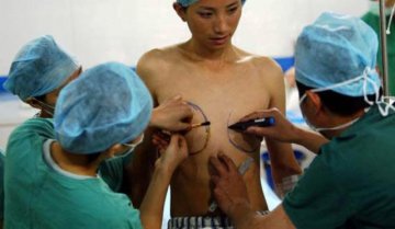首度公开：男人变女人全程