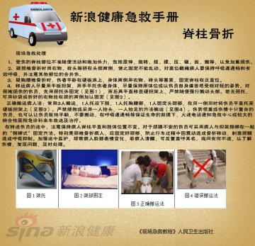脊柱骨折现场急救