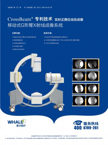 移动式G形臂X射线成像系统-(京药监械(准)字2011第2300457号)精美广告图欣赏