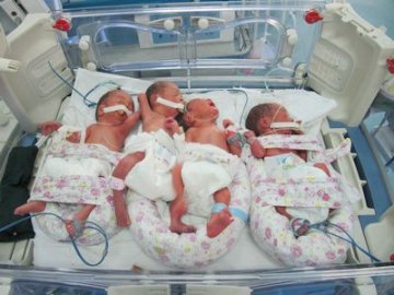 甘肃省妇幼保健院成功助娩四胞胎