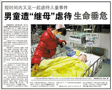 2岁男童遭继母虐待续：病情告急