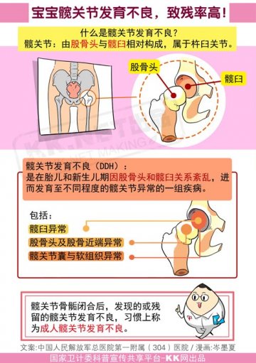 宝宝髋关节发育不良，致残率高！
