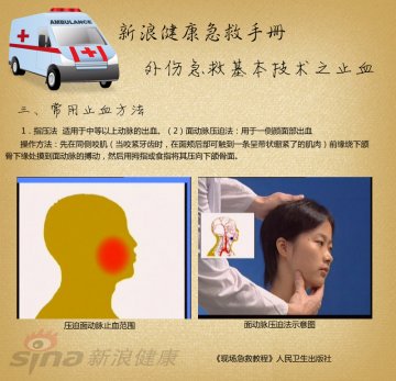 指压止血方法：面动脉压迫法
