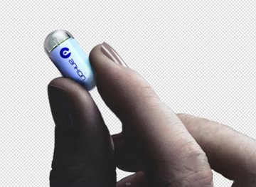 胶囊胃镜：医生控制精确“巡视”