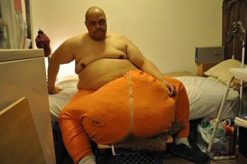 美男子摘除60kg阴囊重获希望