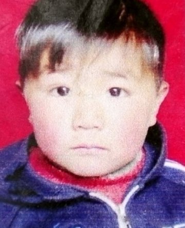 奥特曼男孩王小鹏在北京住院后的日子