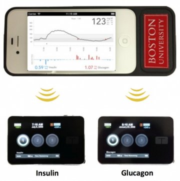 I型糖尿病儿子发明仿生器官