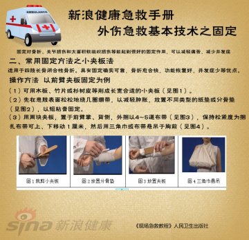 小夹板法操作方法