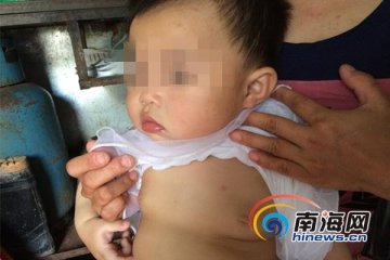 女婴食用奶粉后胸部明显变大 海南食药监局展开调查