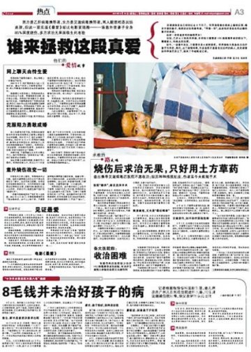 艾滋病携带者烧伤求医未果续：未找到收治医院