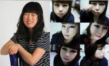 31个惊人韩国整容案例