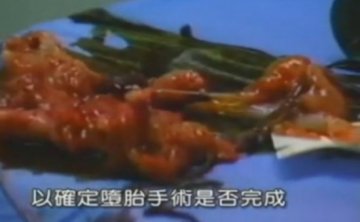 实拍：美国堕胎手术全过程