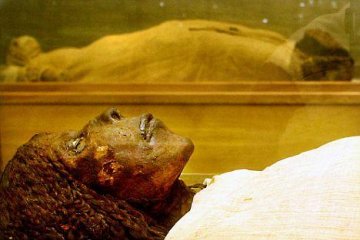 科学家称癌症为人造现代疾病 古代并无癌症