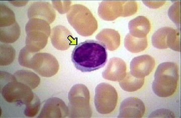 淋巴细胞直接计数（Lymphocyte Count）