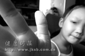 6岁女孩双手粗糙得像中年人